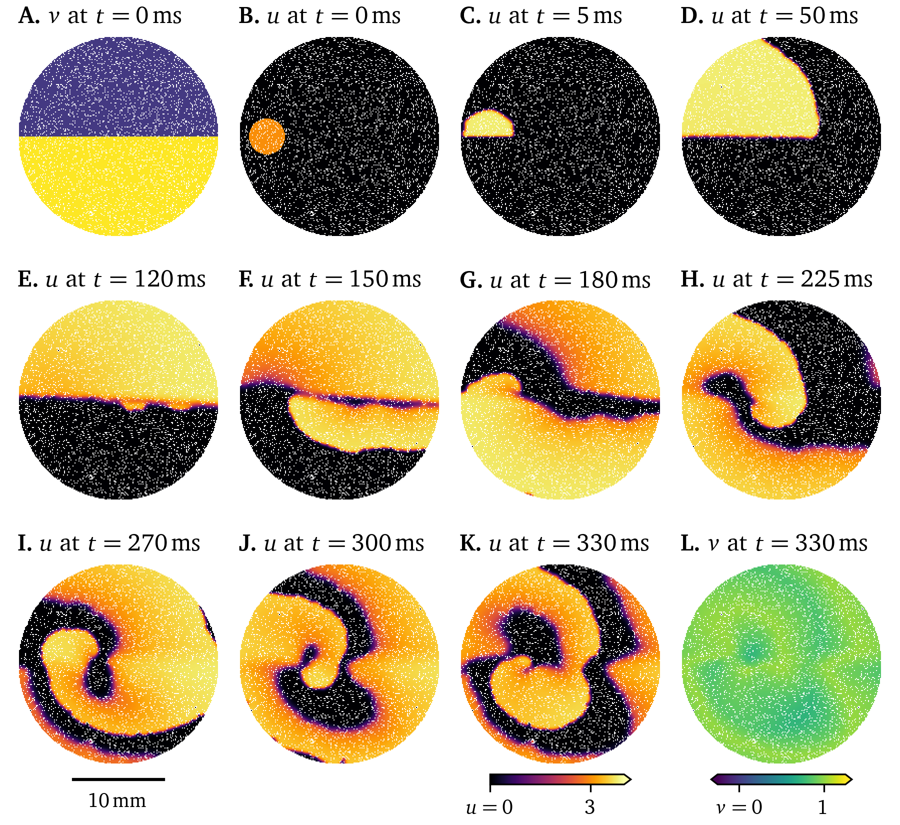 Simulation showing the effect of fibrosis